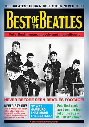 Pete Best
